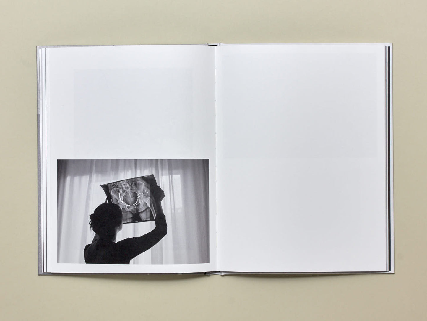 Aliki Christoforou, Anamnesis