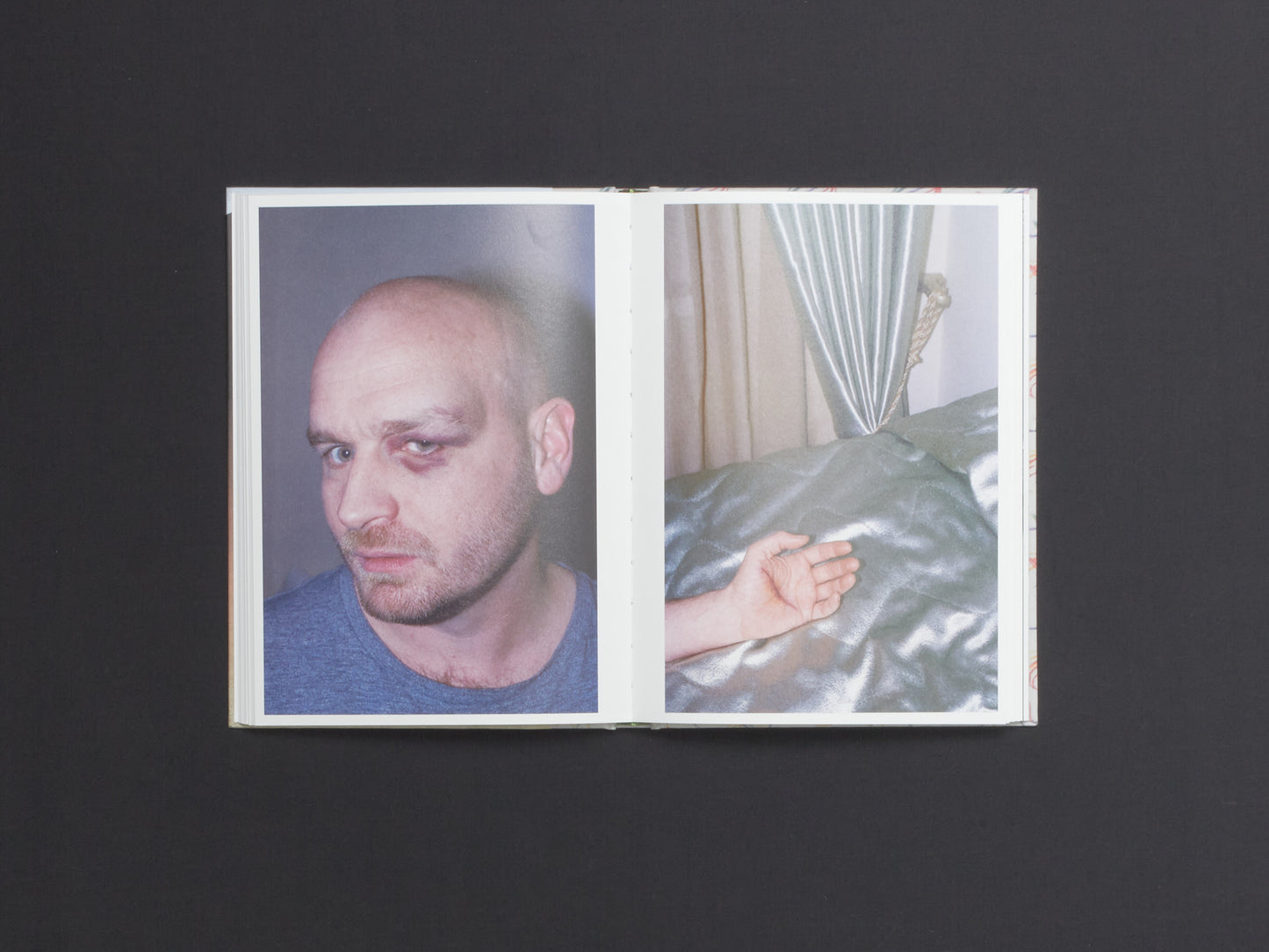 Albert Elm, This Much is True